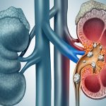 Μιξ Νεφρολιθίασης 120γρ