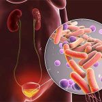 Μείγμα ουρολοίμωξης 120γρ