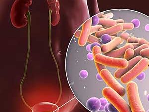 Μείγμα ουρολοίμωξης 120γρ